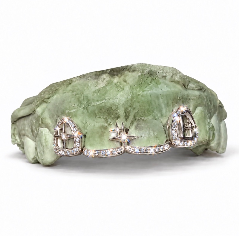 Étoile Grillz